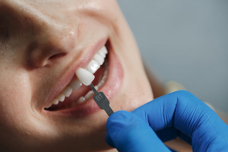 Enhancing Your Smile, The Benefits of Dental Implant Zirconia Crowns