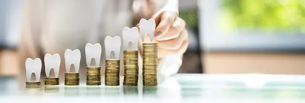 Affordable Dental Implants