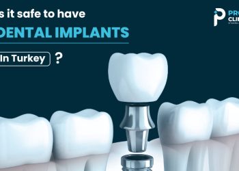 Is it safe to have dental implants in Turkey?