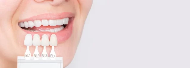 dental implants in Turkey