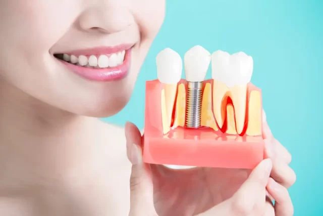 Inserting dental implants concept
