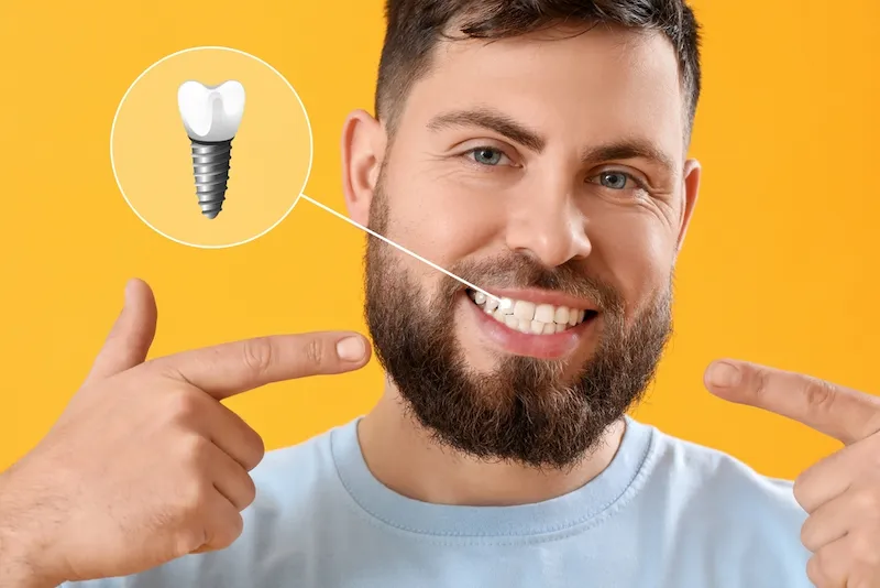 How Long Do Dental Implants Take in Turkey