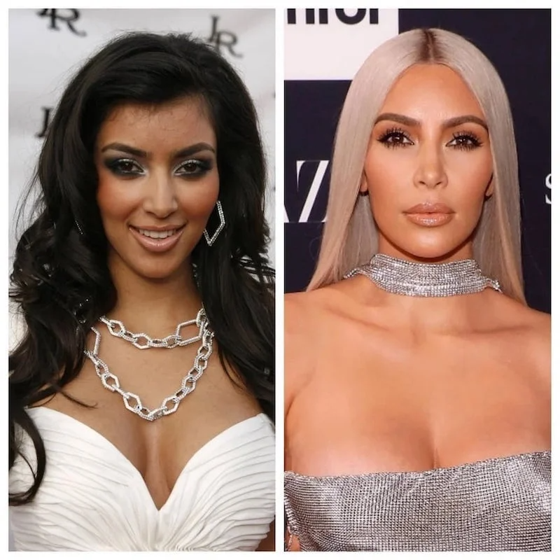 Celebrities and Plastic Surgery