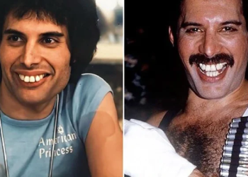 Freddie Mercury’s Teeth: The Iconic Smile He Never Fixed and Why