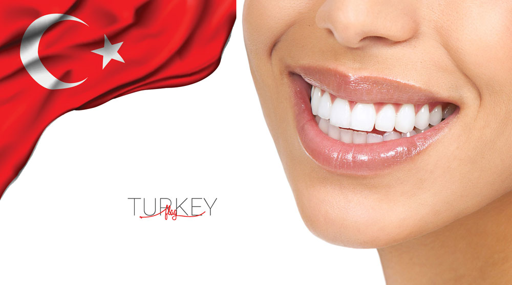 Veneers Turkey