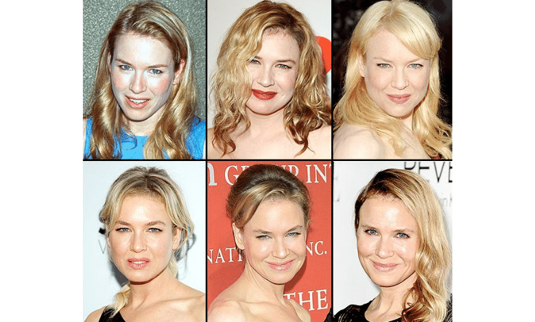 Renée Zellweger Before and After Plastic Surgery