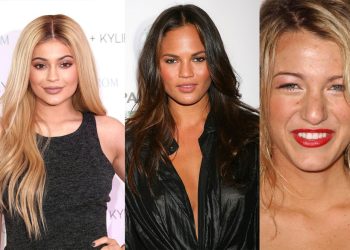 Celebrities and Plastic Surgery: What Procedures Have Famous Faces Had?