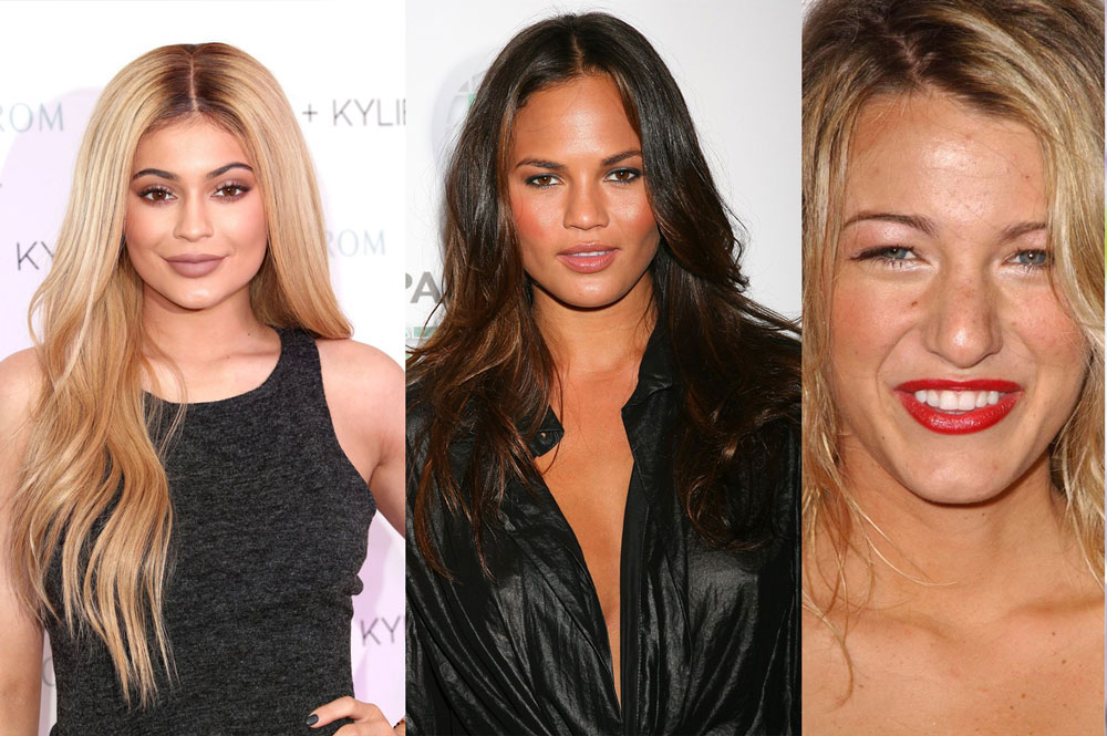 Celebrities and Plastic Surgery: What Procedures Have Famous Faces Had?