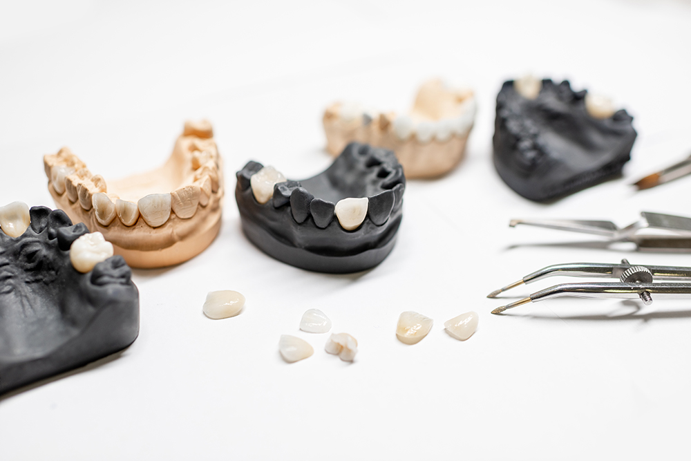 Dangers of Dental Crowns: What You Need to Know