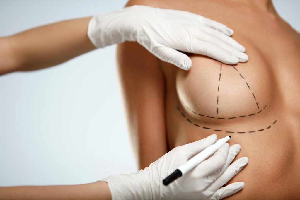 Breast Implants in Turkey: Costs, Safety, and Why Prof Clinic is the Top Choice