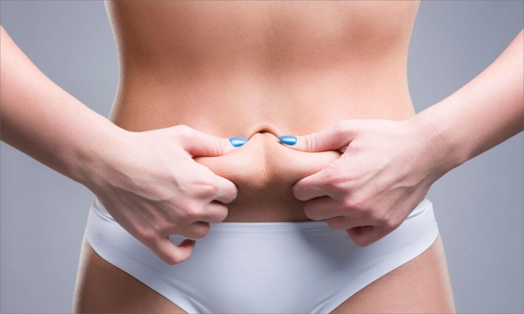 Tummy Tuck Turkey