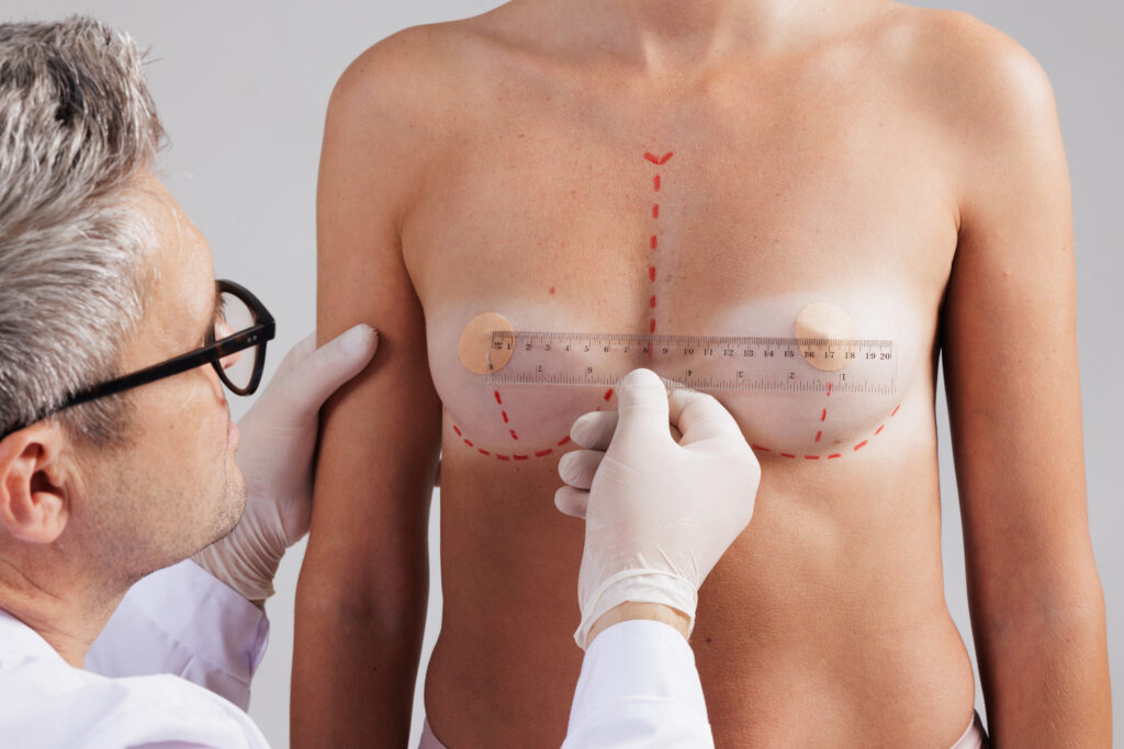 Hybrid Breast Augmentation