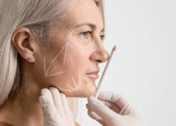 Facelift in Turkey: Costs, Safety, and Choosing the Best Surgeon at Prof Clinic