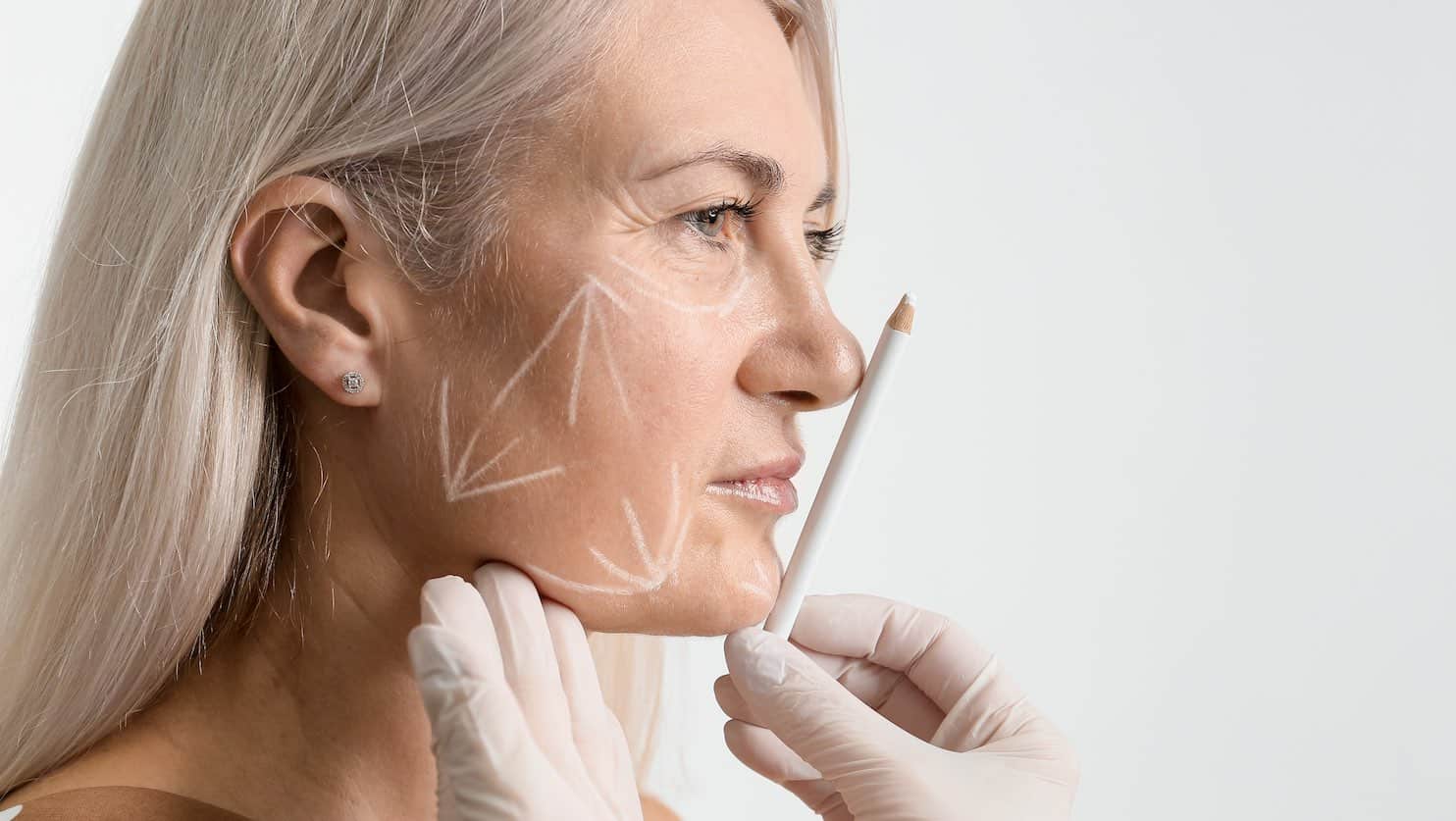 Facelift in Turkey: Costs, Safety, and Choosing the Best Surgeon at Prof Clinic