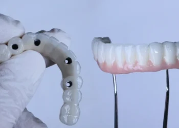 All-on-4 Dental Implants in Turkey: Cost & Advantages