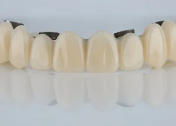 Temporary Veneers in Turkey: What to Know Before Getting Started