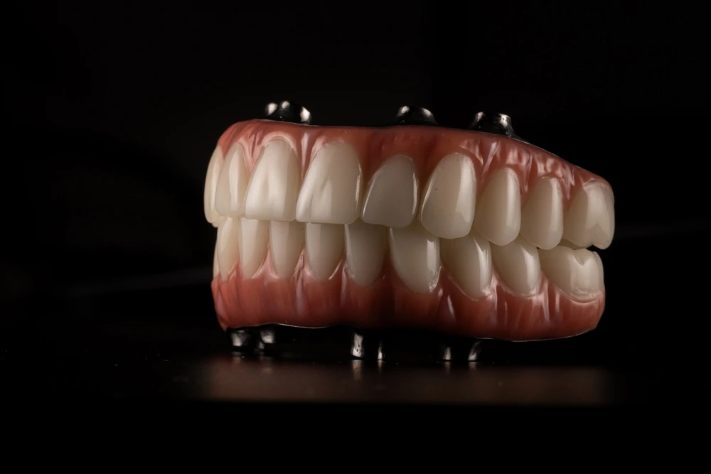 Advantages & Disadvantages of All on Four Implants