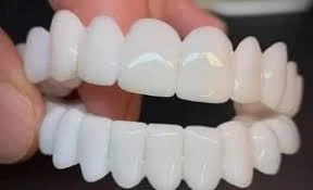 مميزات وعيوب الفينير المتحرك