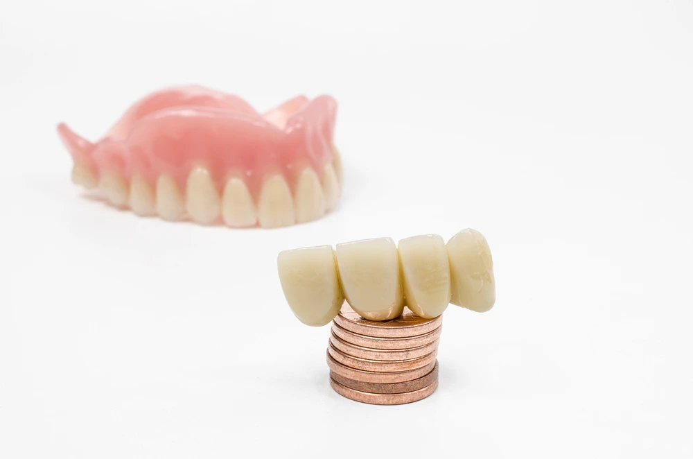 Cost of Temporary Veneers in Turkey