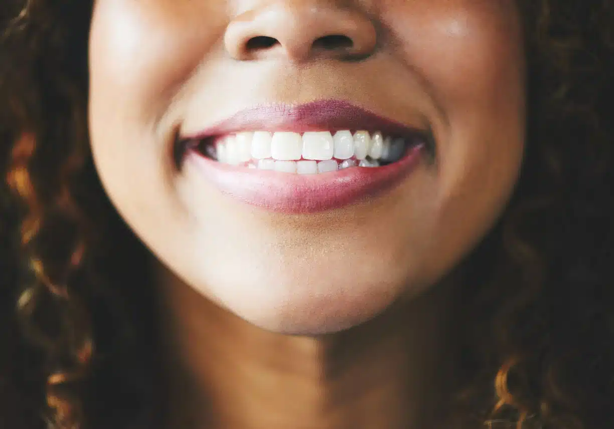 Do Dental Implants Look Natural?