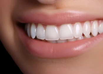 Hollywood vs Bollywood Smile: What is the differences? (Full Guide)