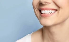 أفضل 5 أنواع ابتسامات أسنان طبيعية