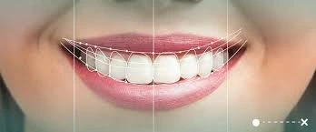 العوامل التي تؤثر على شكل الابتسامة الطبيعية