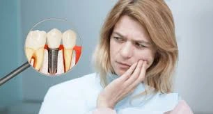 Dental Implant Pain: Causes, Period, & Solutions