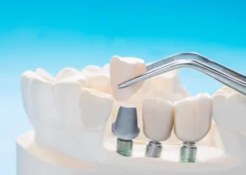 A Dental Implant or a Bridge: What’s Better?