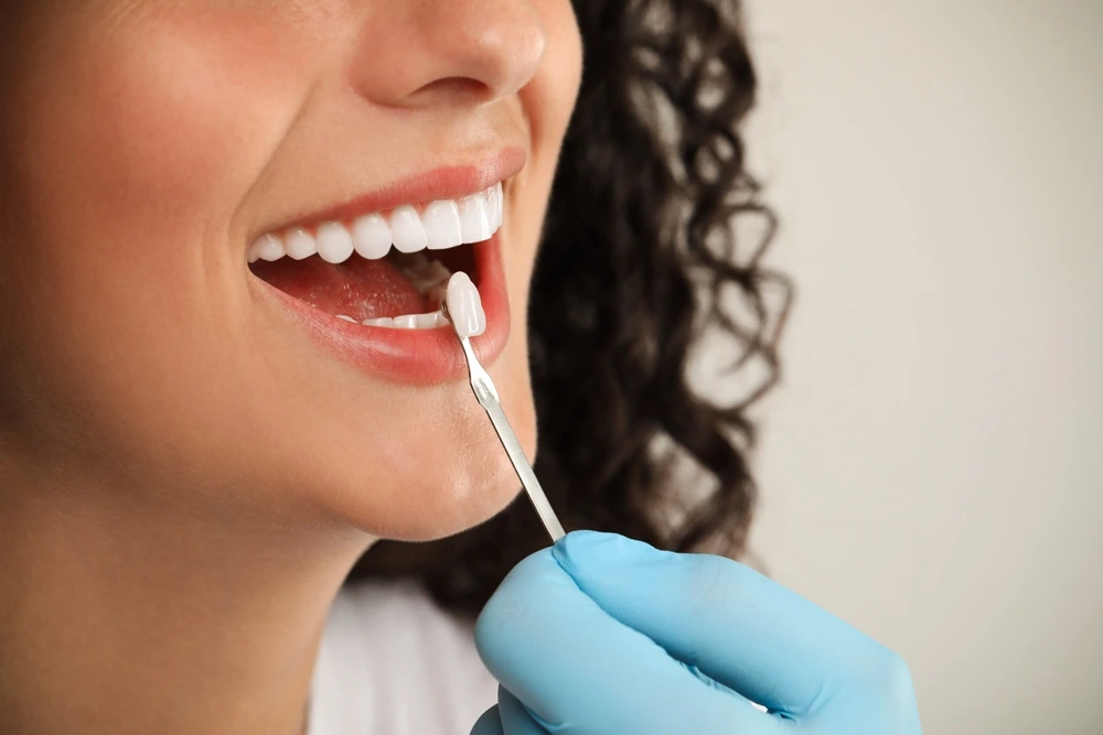 Advantages and Disadvantages of Non-Surgical Dental Implants