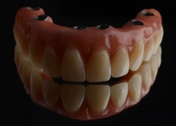 زراعة الأسنان بتقنية الكل على 6: كل ما تحتاج إلى معرفته