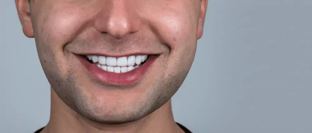 Hollywood Smile Costs: Turkey vs Global Prices (Guide 2025)