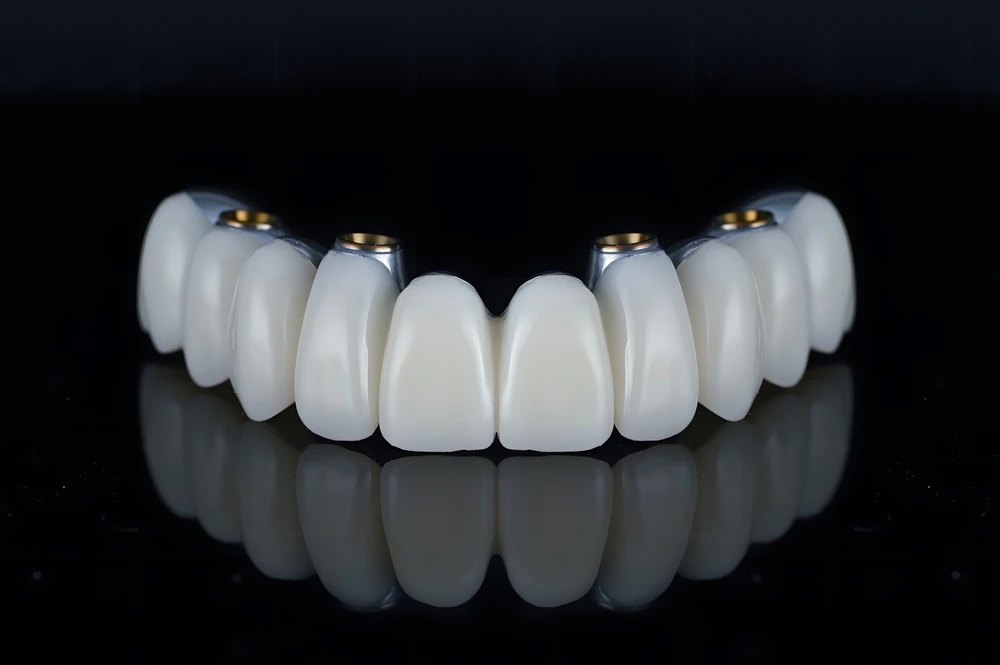 What is the All on Four Dental Implants Procedure?
