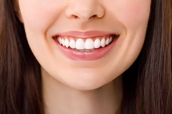 8 Types of Dental Veneers