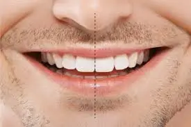 Perfect Teeth: How can you get it?