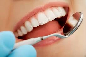 All To Know About Veneers