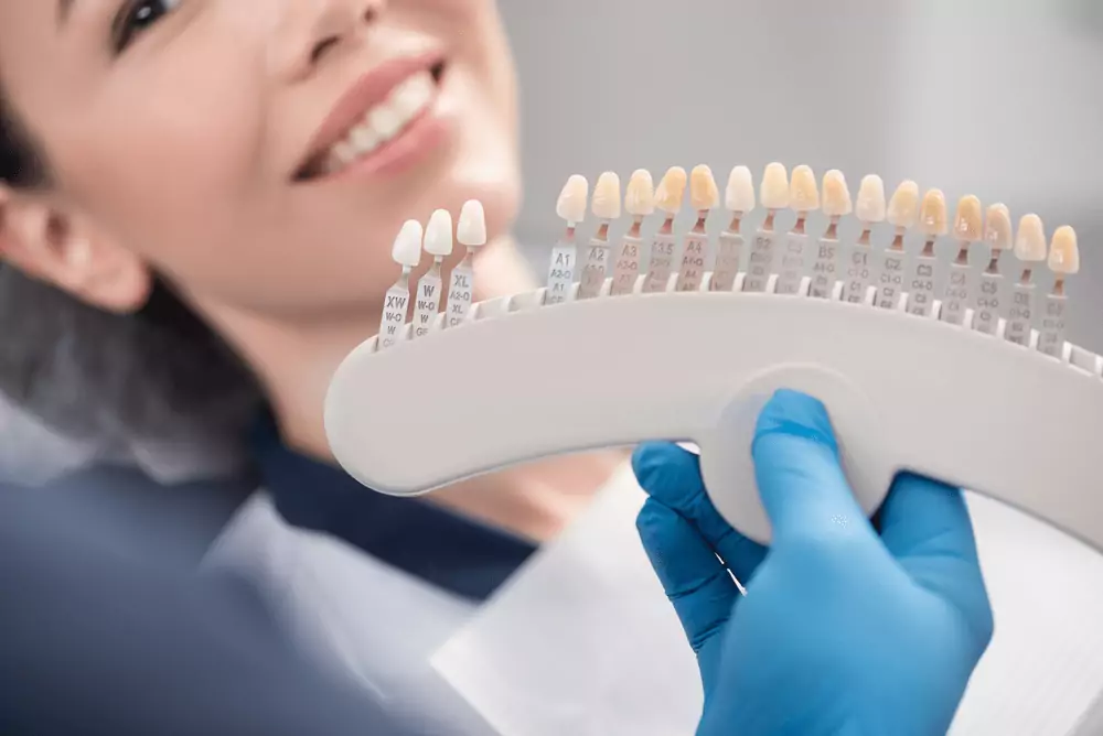 Advantages of veneers in Turkey