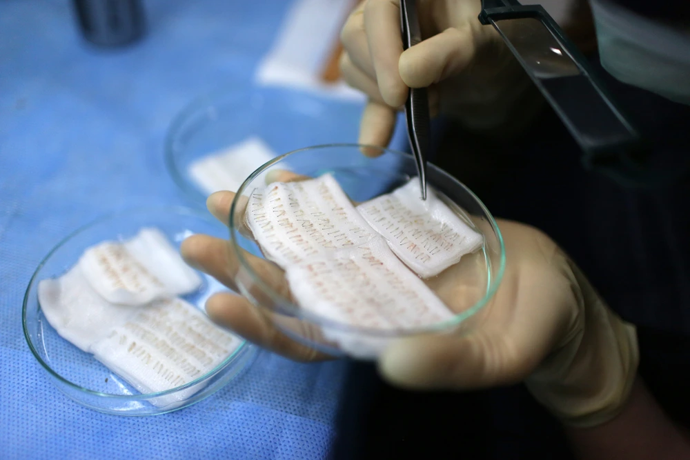 Common hair transplant techniques
