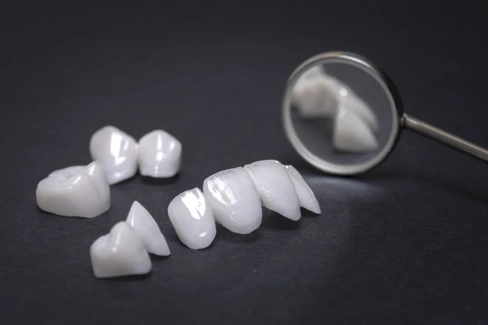 Pros & Cons of ceramic veneers