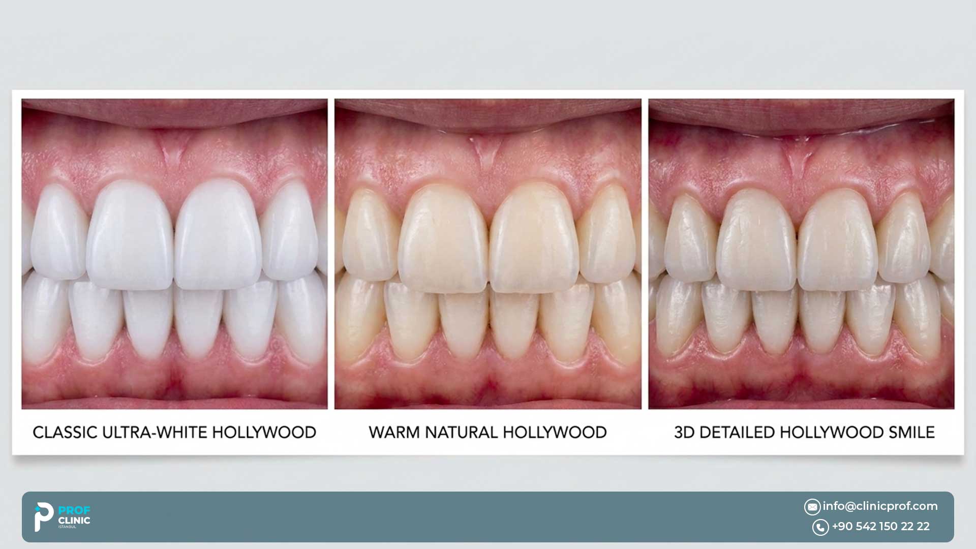 3 Types of Hollywood Smile in Istanbul