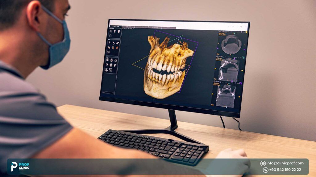 3D Hollywood Smile Price in Turkey