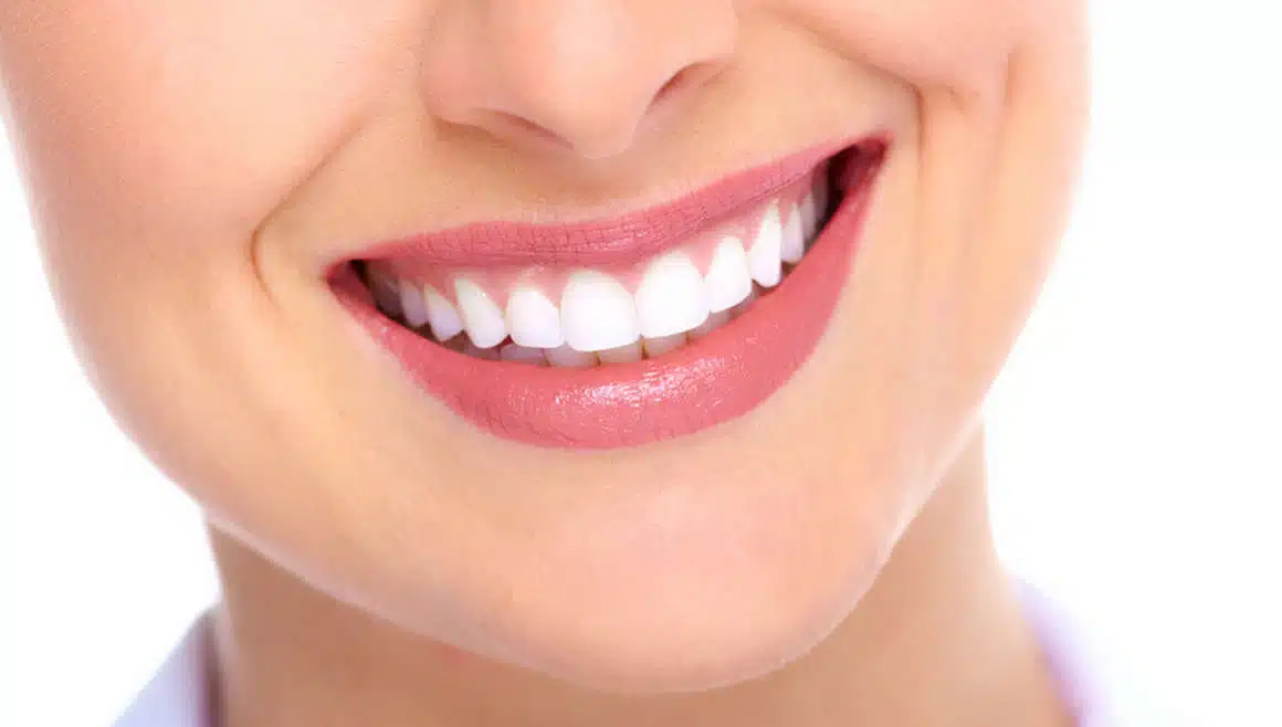 What Is a 3D Hollywood Smile? Features & Price