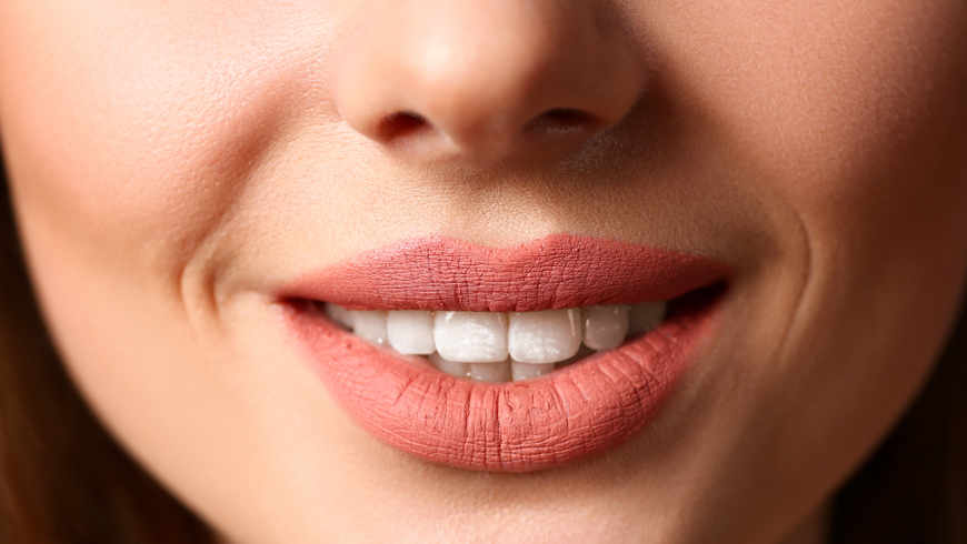 ابتسامة هوليود في تركيا قبل وبعد في عيادتنا