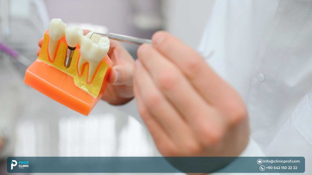 Advanced techniques used for zirconia dental implants