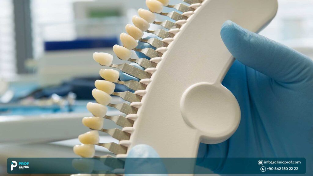 Best Shade for Zirconia Teeth