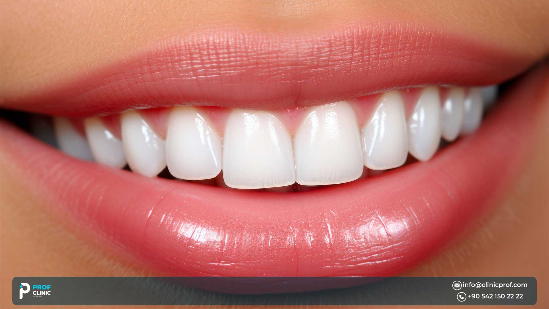 Advantages & Disadvantages of a 3D Hollywood Smile