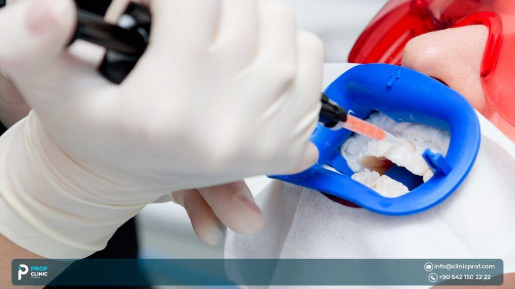 Average Cost of Dental Crown Repair