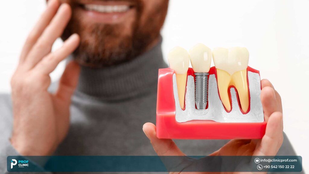 Benefits & Risks of Dental Implants