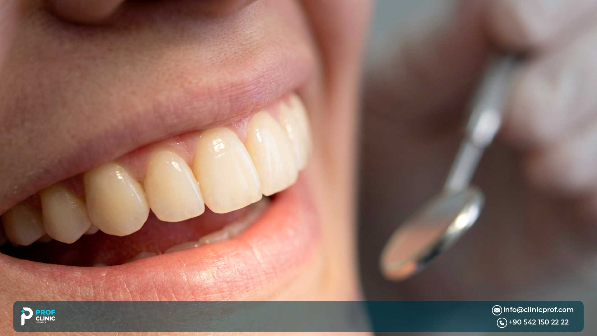 Best Dentist for Porcelain Veneers