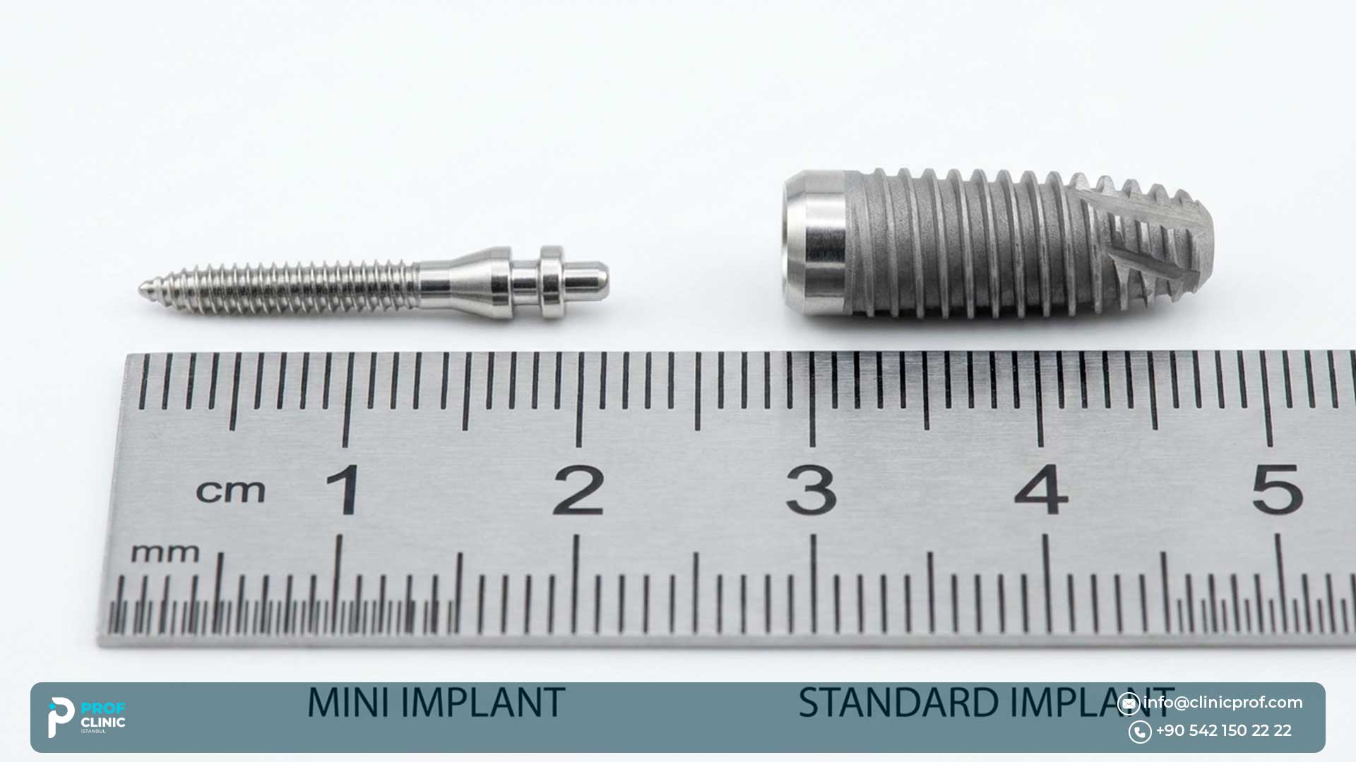 Best Mini Dental Implants (MDI): pros, cons, cost